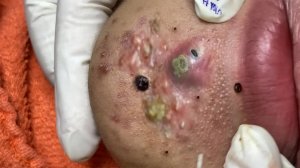 Экстремальное удаление черных точек: расслабляющее видео