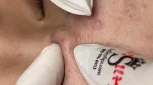 349 • Acne collection • АСМР • Relax Spa