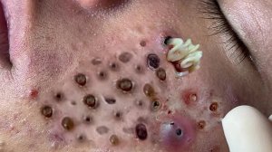 Achieve Inner Peace with These Facial Cleansing Meth�