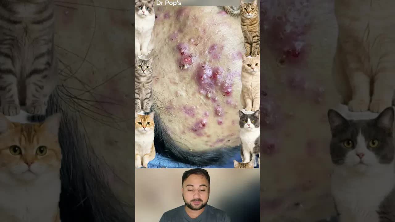 Ultimate Blackhead Removal | Deep Blackhead Extraction | Part 8 смотреть онлайн