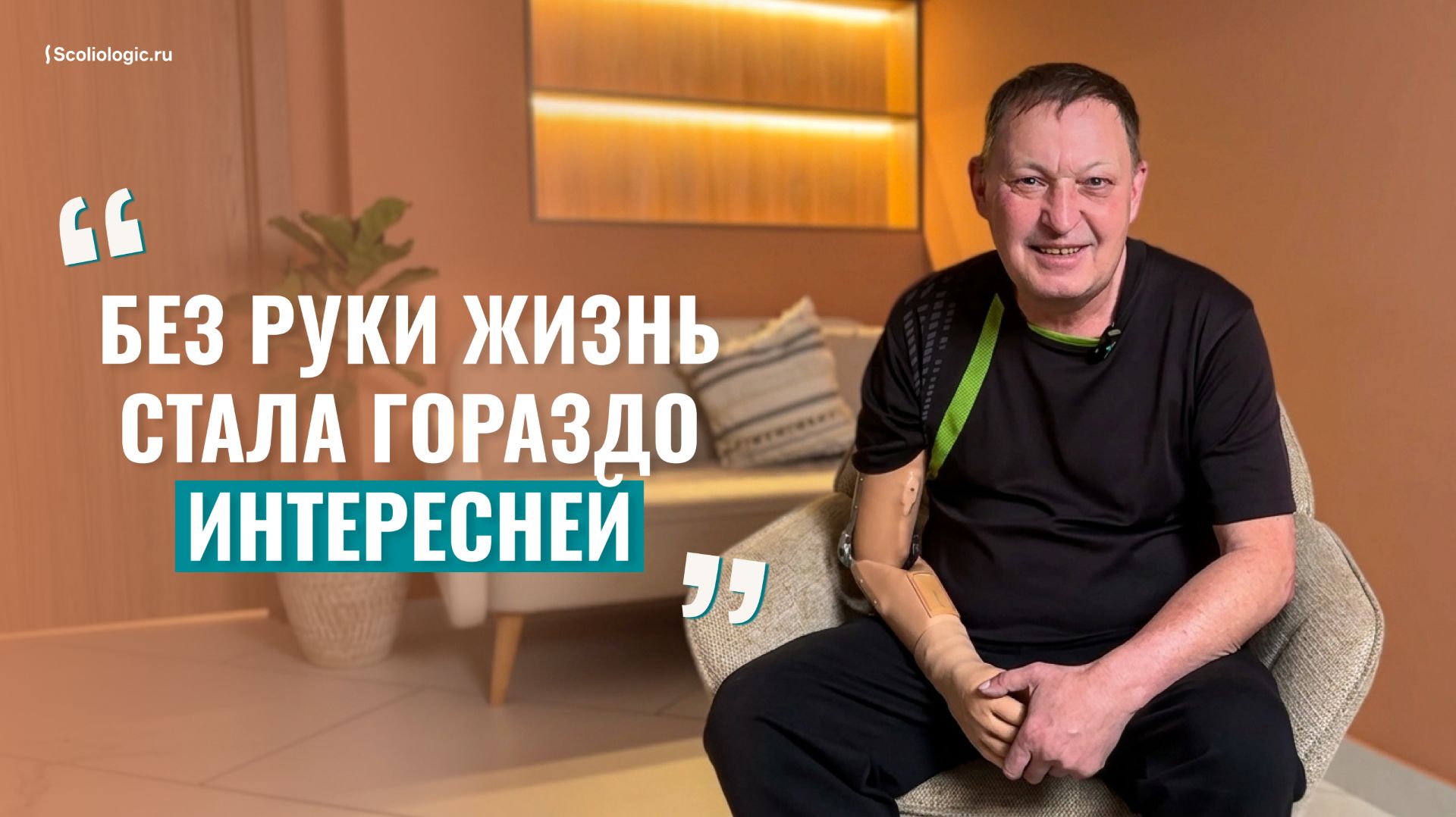 «Мне пришили руку обратно, но что-то не срослось»