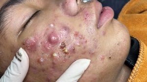 Обретите внутренний покой с помощью этих методов очищения лица