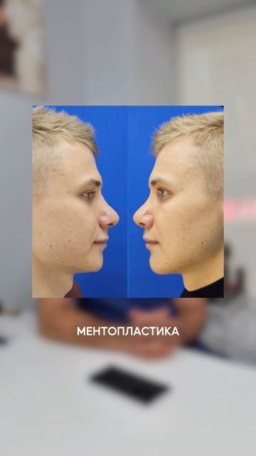 Мужчины тоже хотят выглядеть лучше. Просто говорят об этом гораздо реже😅 смотреть онлайн