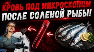 Кровь под микроскопом после соленой рыбы  (скумбрия)