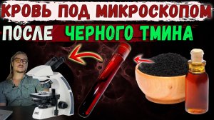 Черный тмин кровь под микроскопом. Наглядные противовоспалительные свойства.