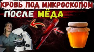 Кровь под микроскопом после мёда