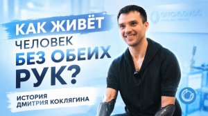 Как живёт человек без обеих рук? История Дмитрия Коклягина | Жизнь с современными протезами