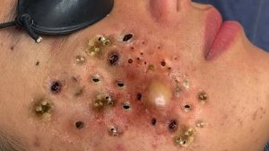 Обретите внутренний покой с помощью этих методов очищения лица