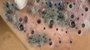 Обретите внутренний покой с помощью этих методов очищения лица