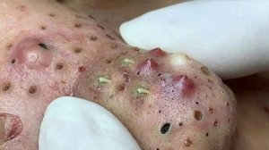 Удаление черных точек Отличное качество