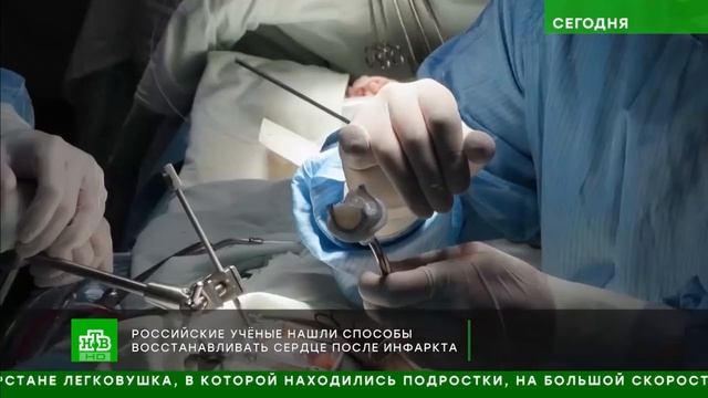 Митральный клапан из перикарда человека. От эксперимента - к первой операции на сердце.