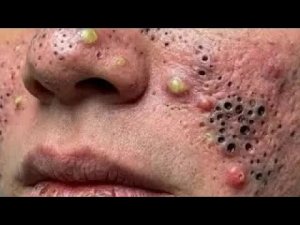 Достигните внутреннего покоя с помощью этих методов очищения лица