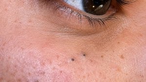 Корейская рутина глубокого очищения пор для жирной и проблемной кожи
