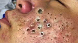 Удаление черных точек Отличное качество