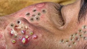 Удаление черных точек Отличное качество