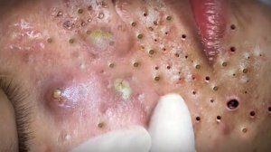 Удаление черных точек Отличное качество