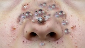 Обретите внутренний покой с помощью этих методов очищения лица