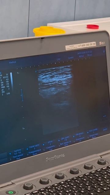 Во время SVF-терапии есть момент, который наши врачи в шутку называют «божественным светом»