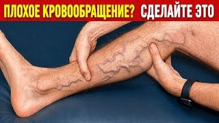ЭТИ ПРОСТЫЕ УПРАЖНЕНИЯ ПОМОГУТ ПРИ ВАРИКОЗЕ И СОСУДИСТОЙ СЕТОЧКИ. смотреть онлайн