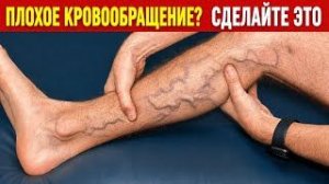 ЭТИ ПРОСТЫЕ УПРАЖНЕНИЯ ПОМОГУТ ПРИ ВАРИКОЗЕ И СОСУДИСТОЙ СЕТОЧКИ.