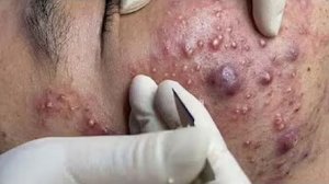 Удаление черных точек Отличное качество
