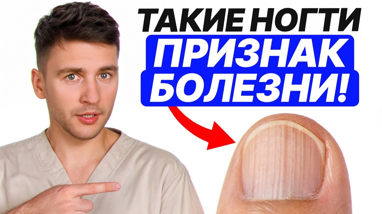 Природа подарила вам индикатор болезней, но 99% людей им НЕ ПОЛЬЗУЮТСЯ! О чем кричат ваши ногти?