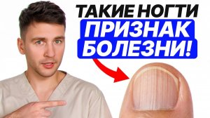 Природа подарила вам индикатор болезней, но 99% людей им НЕ ПОЛЬЗУЮТСЯ! О чем кричат ваши ногти?