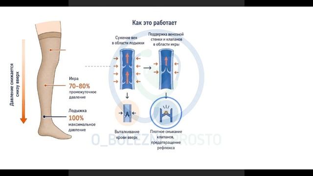 компрессионное белье смотреть онлайн