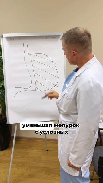 О самой популярной бариатрической операции рассказываю в видео.