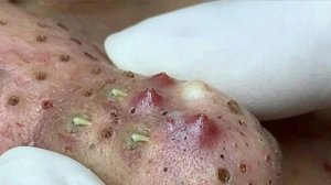 Удаление черных точек Отличное качество