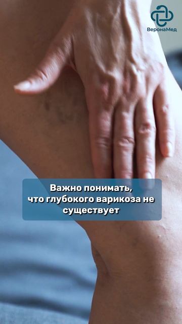 Когда требуется операция при варикозном расширении вен?#варикозног #варикоз #варикозноерасширениевен