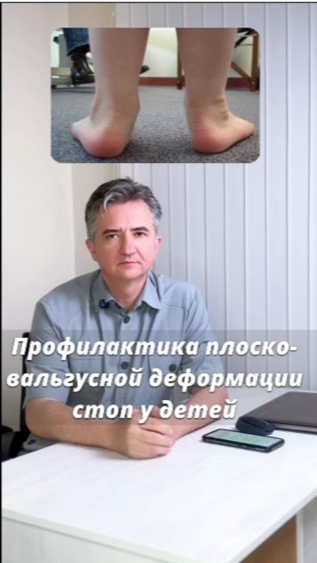Профилактика плоско- вальгуса у детей