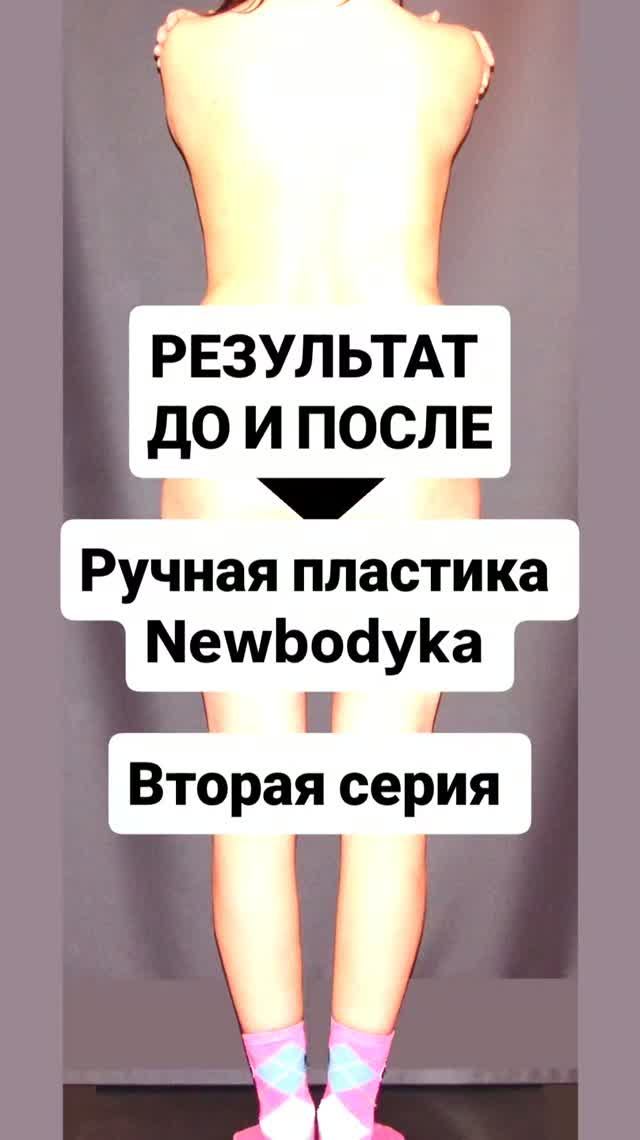РЕЗУЛЬТАТ ДО И ПОСЛЕ, метод - ручная пластика тела и лица NewBodyKa. Вторая серия
