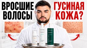 ВРОСШИЕ ВОЛОСЫ и «гусиная кожа»: схема ухода за телом | MESOMATRIX