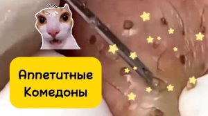 1,5 часа. Чистка лица от угрей и акне. Выдавливание прыщей. Удаление черных точек и комедонов