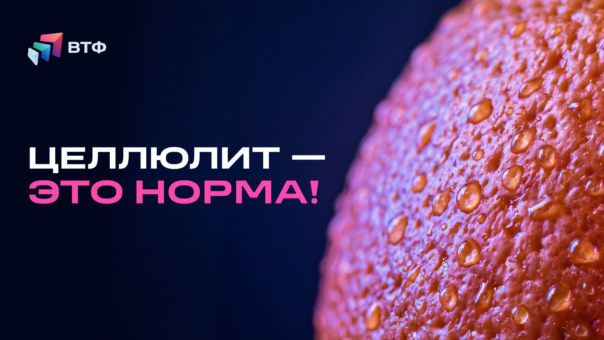ЦЕЛЛЮЛИТ У ЖЕНЩИН: почему возникает и что с ним делать