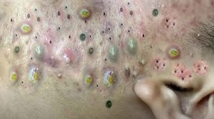 Достигните внутреннего покоя с помощью этих методов очищения лица