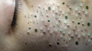 Обретите внутренний покой с помощью этих методов очищения лица
