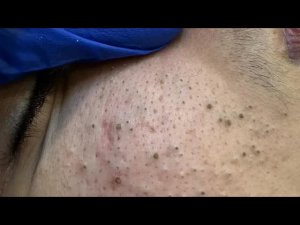 Чудодейственная корейская рутина ухода за кожей (чистая и сияющая)
