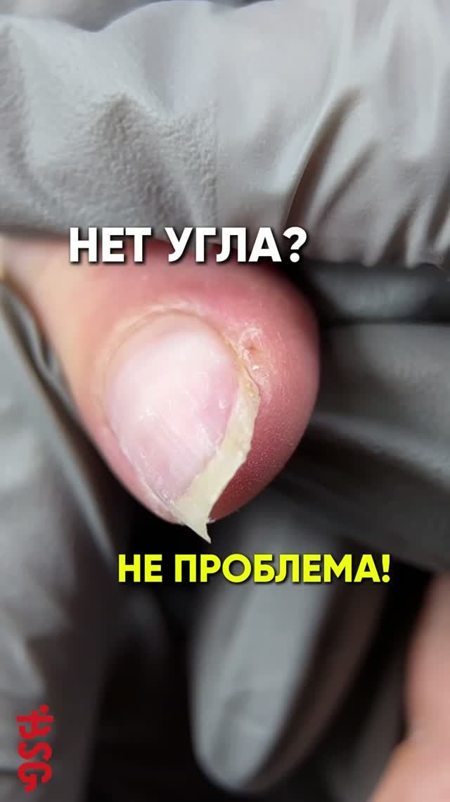🚨 Самая частая проблема после переношенного покрытия — исчезнувшие углы.