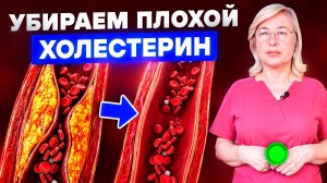 убираем плохой холестерин