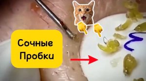 1,5 часа. Чистка лица от угрей и акне. Выдавливание прыщей. Удаление черных точек и комедонов