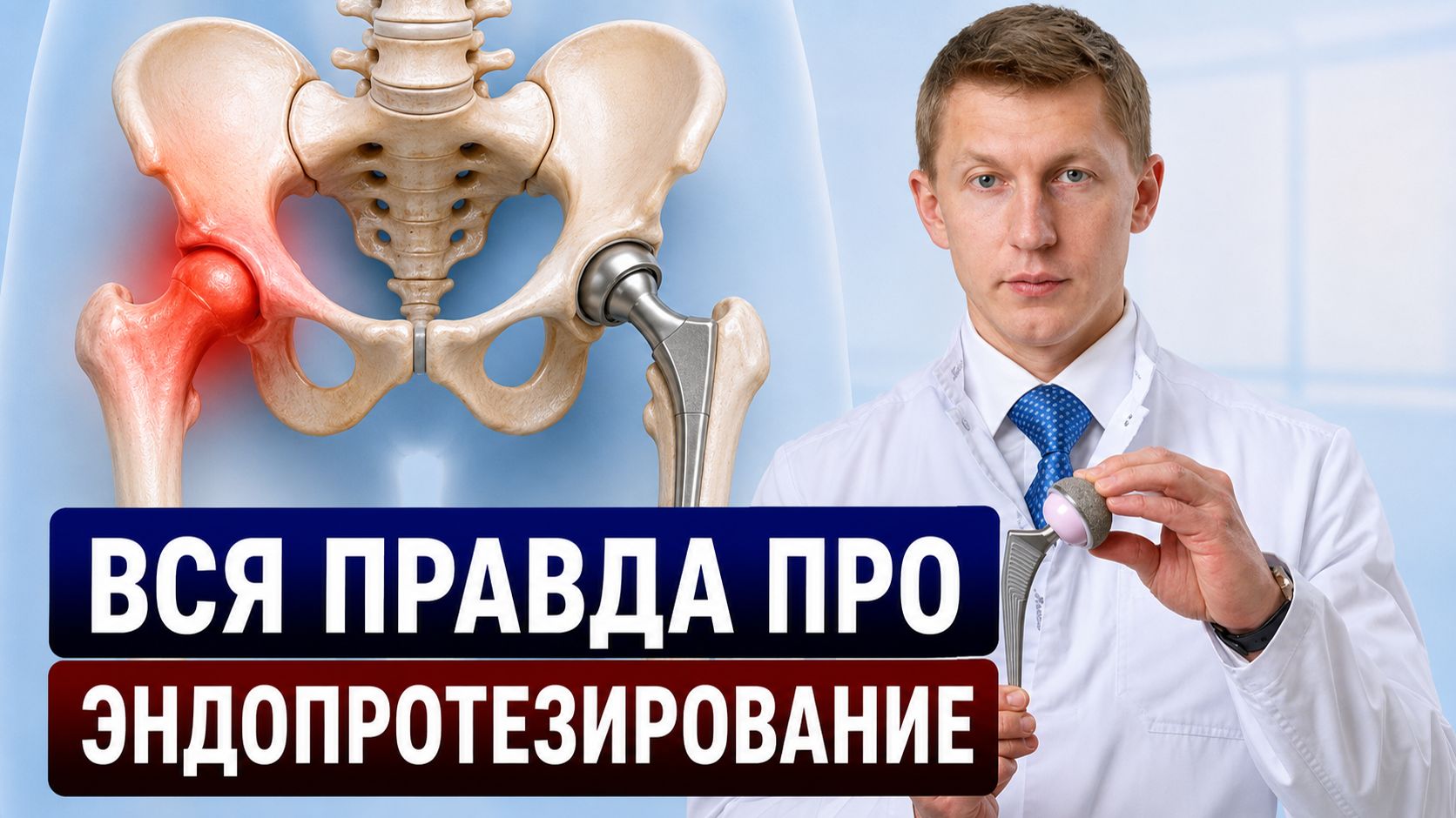 Что скрывают об эндопротезировании? Вся правда о замене тазобедренного сустава!