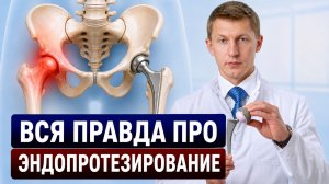 Что скрывают об эндопротезировании? Вся правда о замене тазобедренного сустава!