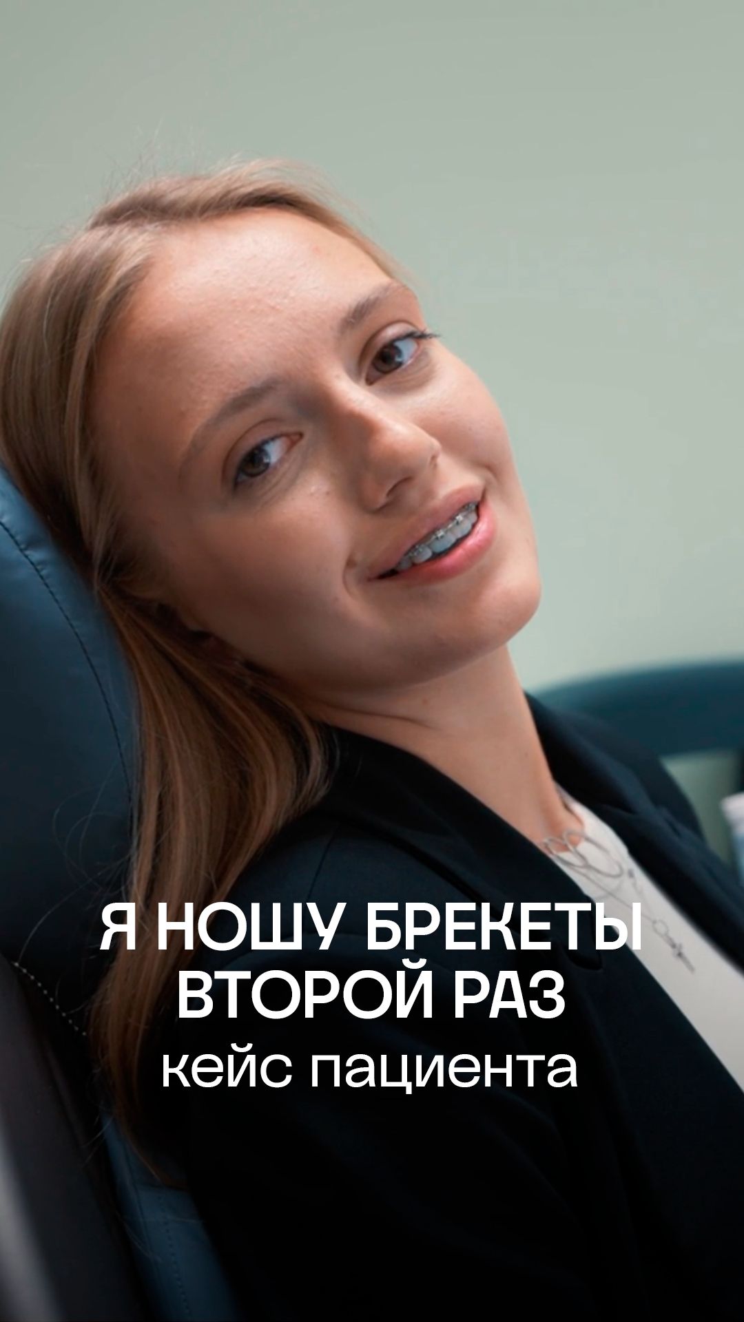 Я ношу брекеты второй раз: отзыв пациентки | ПрезиДЕНТ 💚