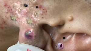 Поделитесь советами по очищению и уходу за лицом