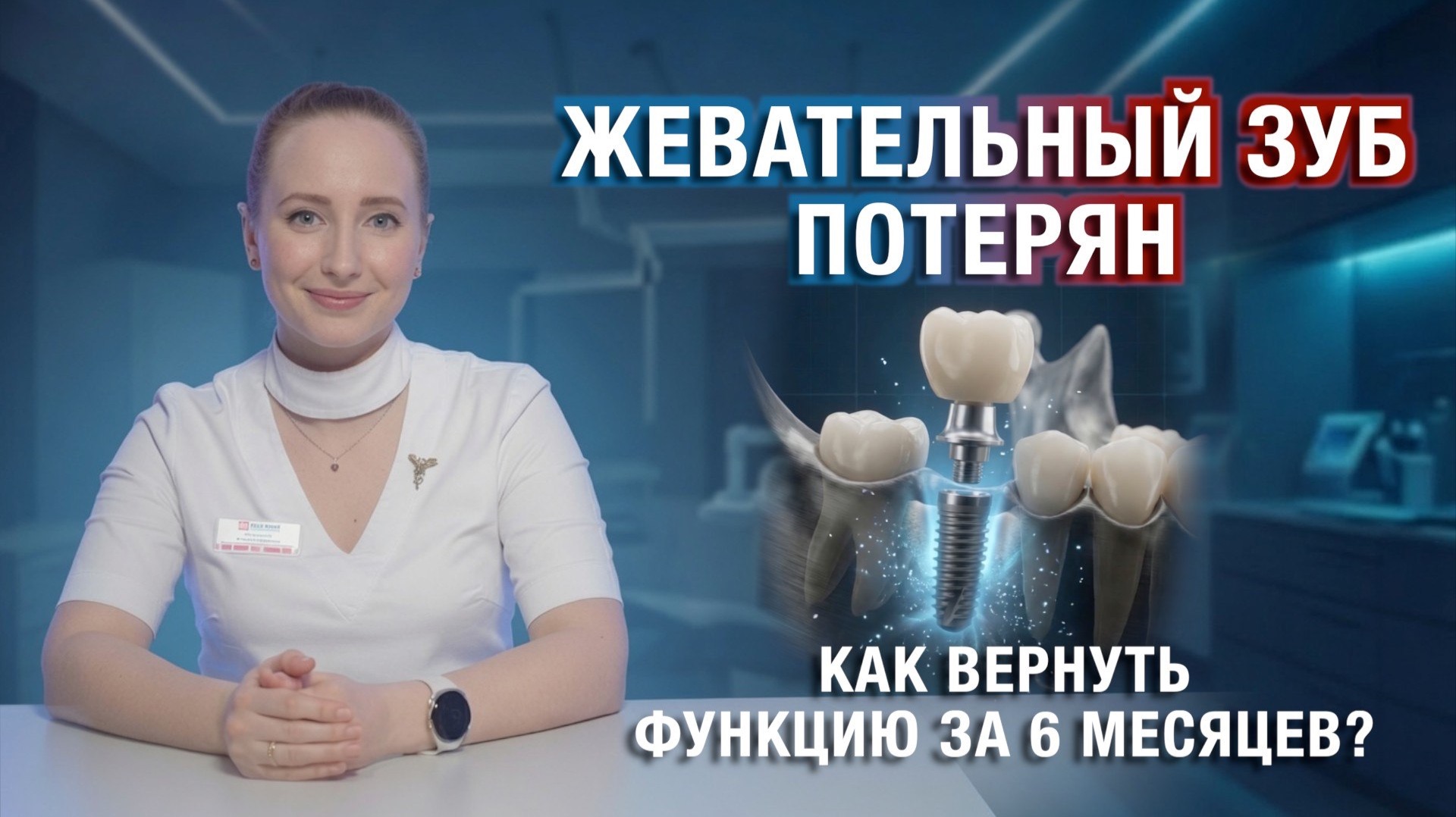 Имплантация жевательных зубов: полный разбор методов, рисков и сроков. Какой метод имплантации лучше