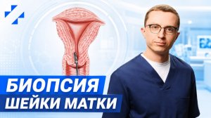 Биопсия шейки матки