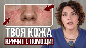 Кожа ПРЕДУПРЕЖДАЕТ о внутренних проблемах! / 5 СИГНАЛОВ, которые ты игнорируешь