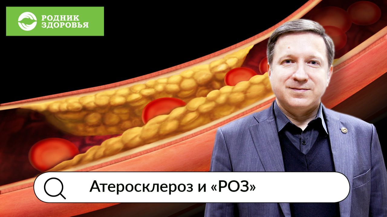 Атеросклероз и РОЗ. Вебинар